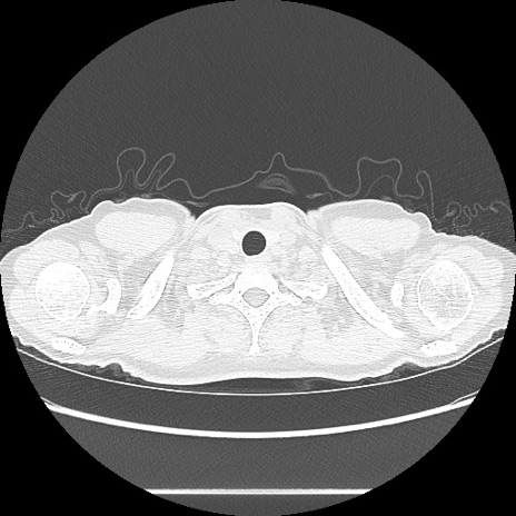 Thin Slice画像とは – 人工知能 Thin Slice – AOYU
